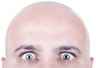 プロペシア、ミノタブ、ロゲイン、AGA治療薬